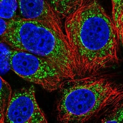 UQCRQ Antibody, Novus Biologicals 0.1mL; Unlabeled:Antibodies, Polyclonal